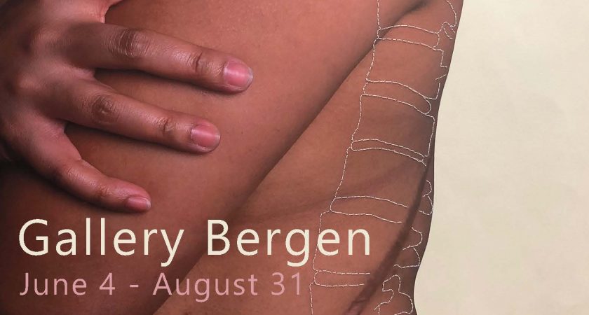 On the Mend at Gallery Bergen